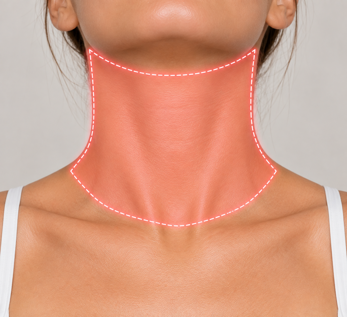 Neck Skin Needling
